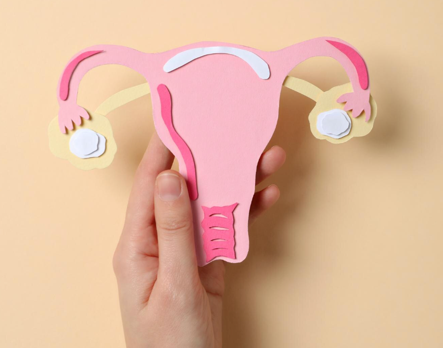 PCOS Is Getting a New Name: Here's What PMOS Means for Women's Hormonal Health