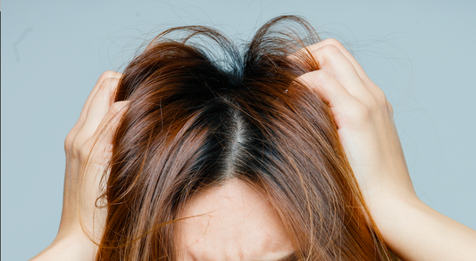 Why Your Scalp Is Sending You Hormonal Signals: Understanding Scalp Health and PMOS (Formerly Known as PCOS)