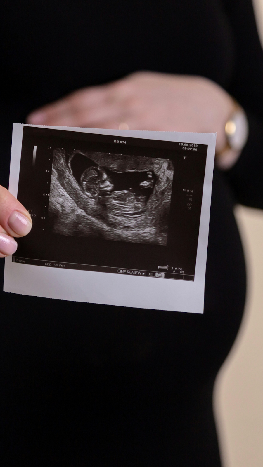 Fertility Support For Women